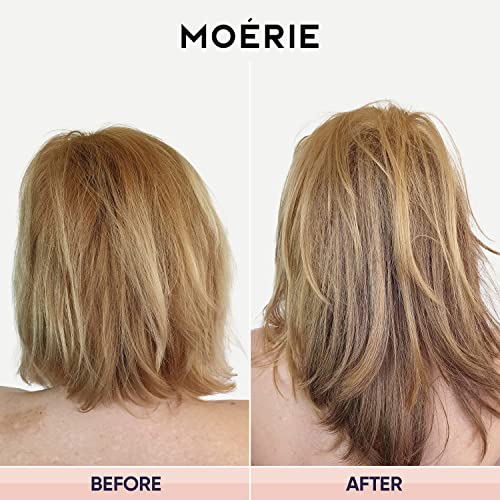 Moerie Ultimate Hair Growth Spray Designed to Strengthen & Stop Hair Loss - 100% Natural Serum for with over 100 Minerals, Vitamins & Amino acids - Fresh Scent - 5.07 Fl. Oz