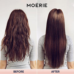 Moerie Ultimate Hair Growth Spray Designed to Strengthen & Stop Hair Loss - 100% Natural Serum for with over 100 Minerals, Vitamins & Amino acids - Fresh Scent - 5.07 Fl. Oz