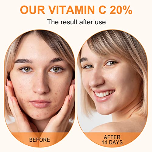 Premium 20% Vitamin C Serum For Face with Hyaluronic Acid, Retinol & Amino Acids - Boost Skin Collagen,Hydrate & Plump Skin, Anti Aging & Wrinkle Facial Serum 60ml